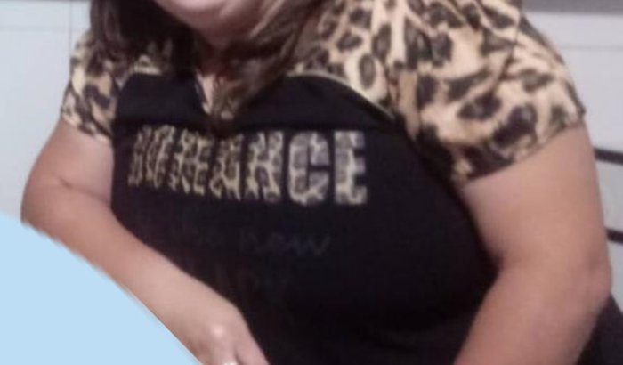 Pré e pós Cirurgia Bariátrica