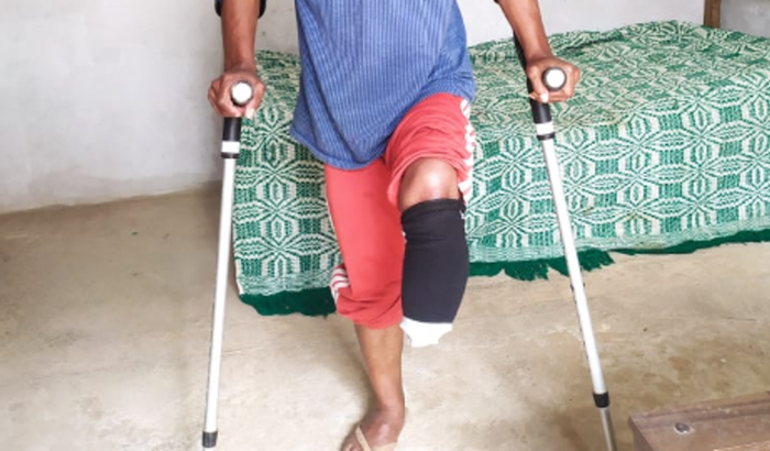 Ajuda pra comprar uma prótese 