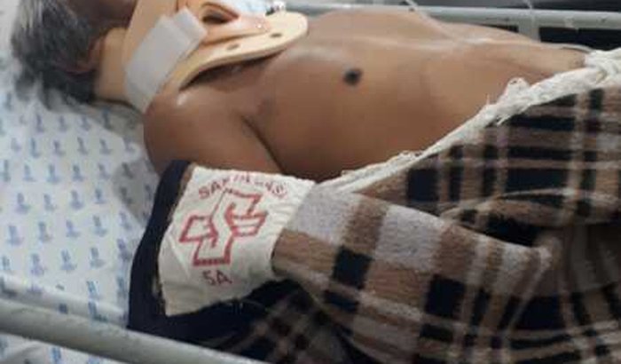 E prol do sr orlando que operou a coluna 