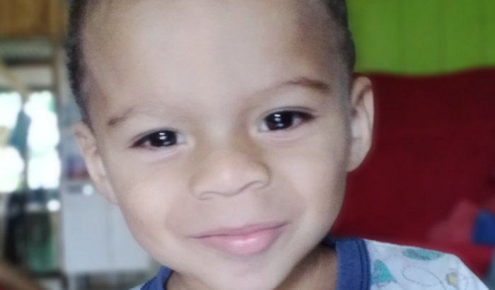 Exame Bera Com Sedação