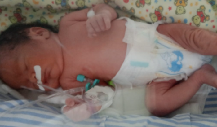 Ajuda com tratamento de saúde da pequena MARIA ISADORA