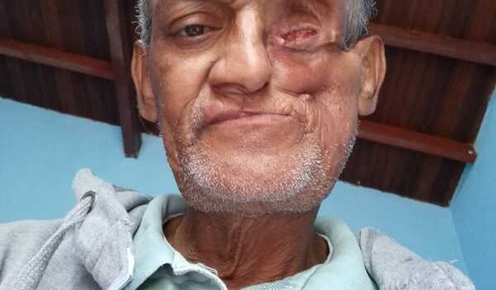 Ajudar meu pai com câncer 