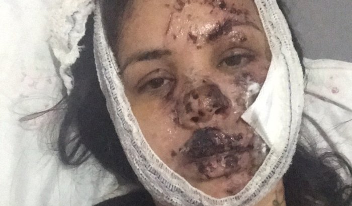 Fazer cirurgia no rosto