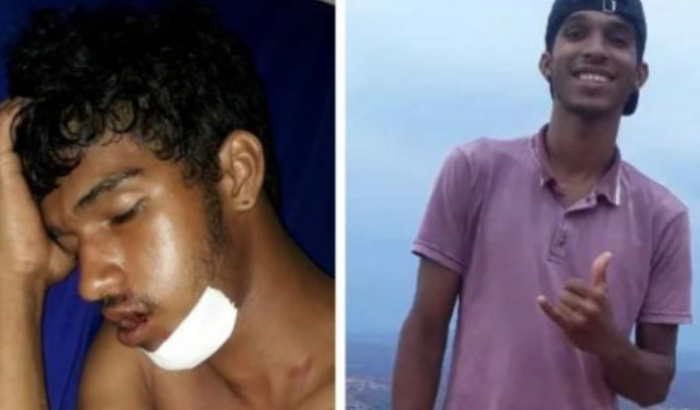 Em prol a cirurgia de Alessandro