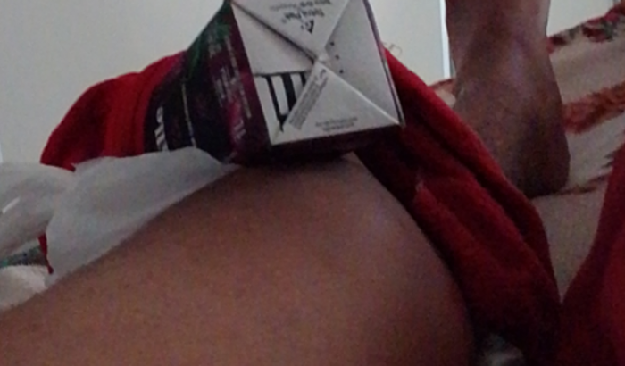 Cirurgia de emergência 