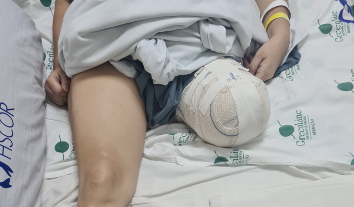 Campanha #PróteseParaSônia 