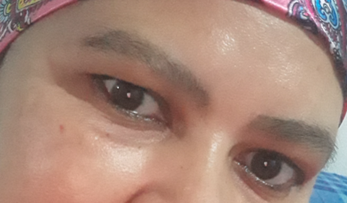 ajuda para tratar câncer de mama