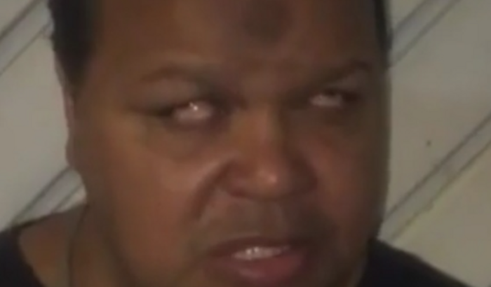 VAMOS AJUDAR ELE GENTE A DOENÇA QUE ELE TEM E PERIGOSA MENINGITE E OVERCOSE