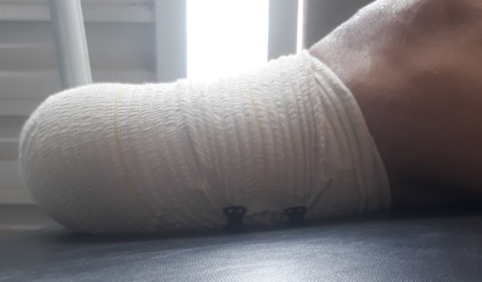 Pra mim pôde adquirir minha prótese ortopédica 