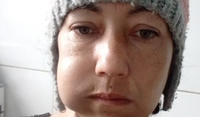 Ajuda no tratamento da minha irmã Michelle