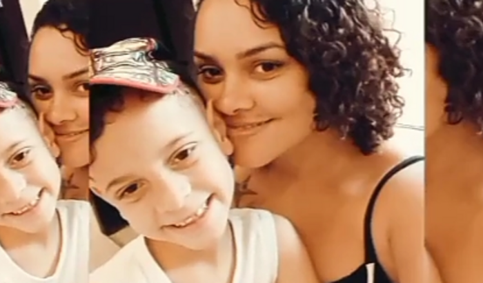 Transplante Capilar do Lohan Gusttavo