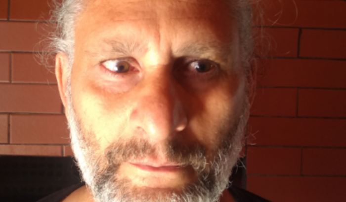 Tratamento alternativo para diminuição de cegueira ambos os olhos, tratamento realizado somente fora do país . 