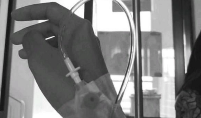 Cirugia e uma tomografia com urgência apendicite 