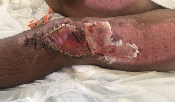 Ajuda pra Ian Pablo Barreto lima 