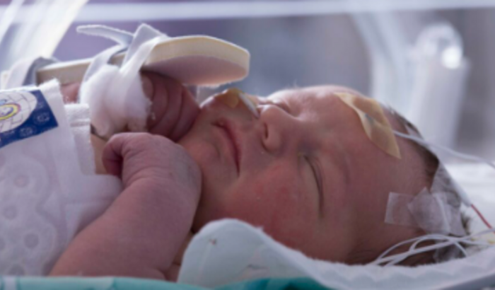 HIPERAMONEMIA - HELOISA VASQUEZ FRANCO