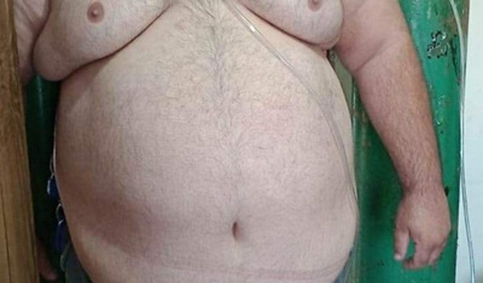 Sos bariátrica Angelina caron Curitiba 