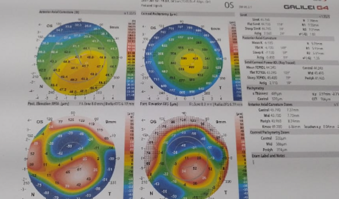 AJUDE O LUCAS A REALIZAR AS CIRURGIAS E NÃO PERDER A VISÃO