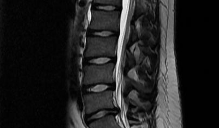 Ajuda para processo cirurgico