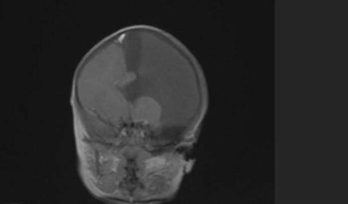 Um quartinho para o Leon todo adaptado para ele explora