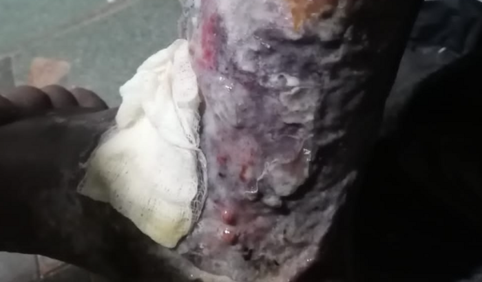 Ajudar pai de família e custear o tratamento de saúde 