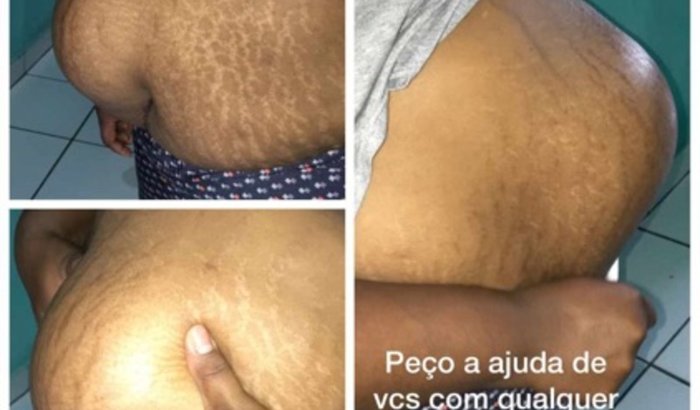 Um pedido de Ajuda para Cirurgia de emergência 