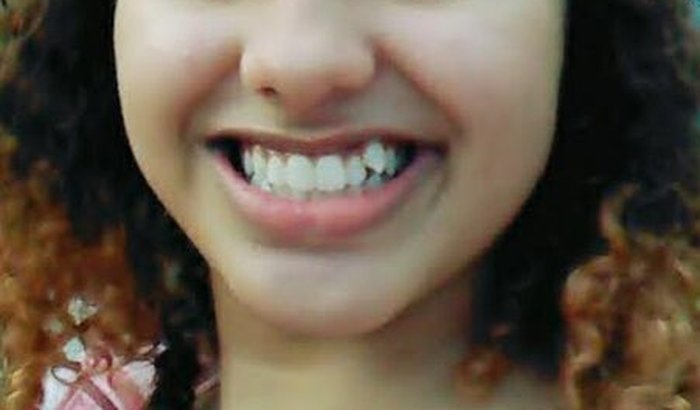 Tratamento dentario,bota ortopédica e oculos de grau...