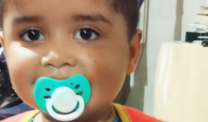 Tratamento do Kallebe