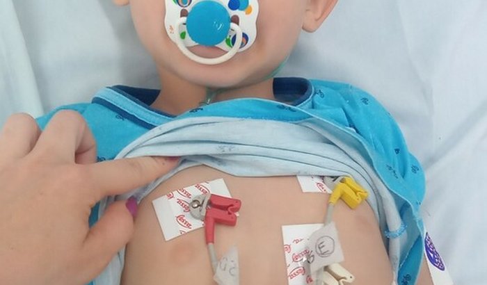 Consulta pneumologista Otävio