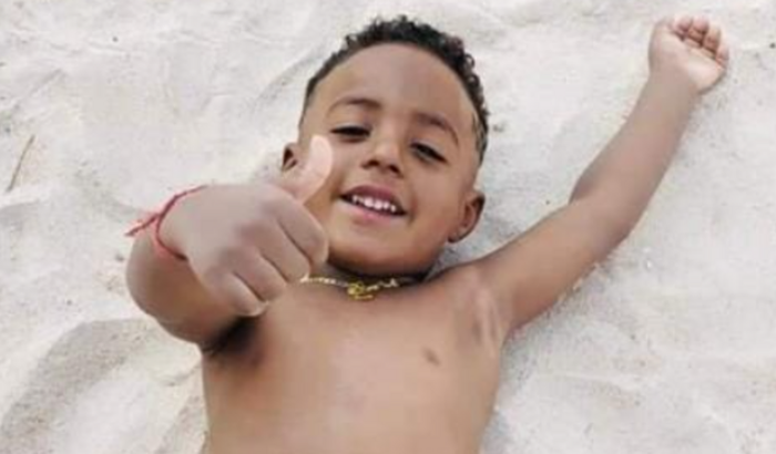 Bryan Lucca Adenóide nariz e ouvido 