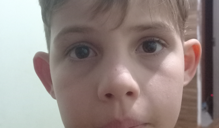 Todos unidos para realização da cirurgia  do pequeno Davi