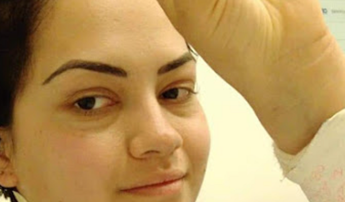 Cirurgia de Catarata