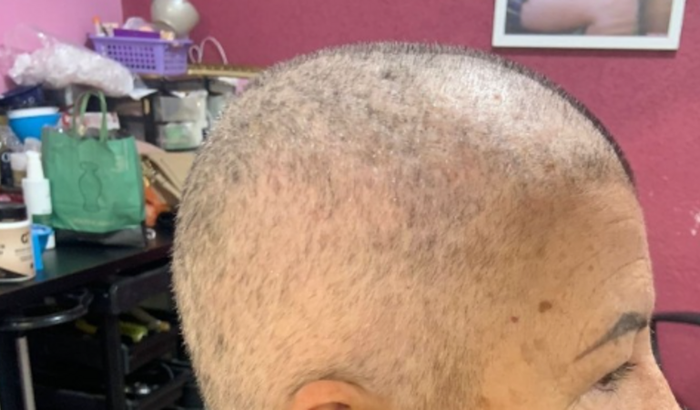 Tratamento oncológico da nossa mãe