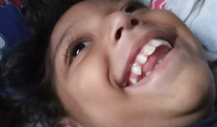 Compra de canabediol e parapodio pra NOAH