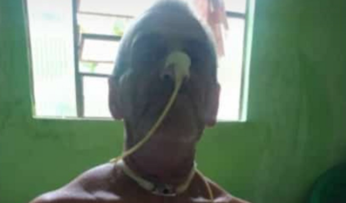 Nos ajude no tratamento de câncer do meu sogro