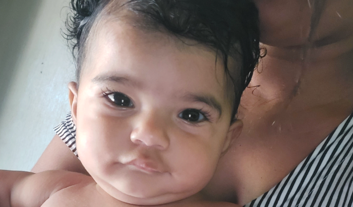 Ajuda para fazer uma cirurgia nos olhos de um bebê de 1 ano.