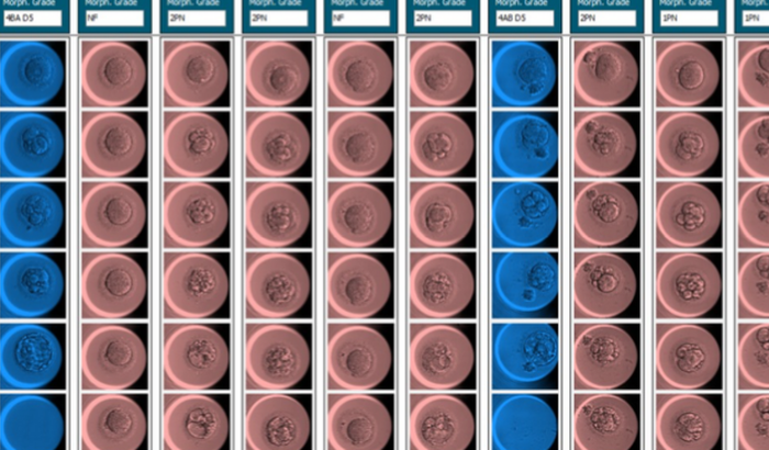 Bebe Arco-íris fertilização in vitro