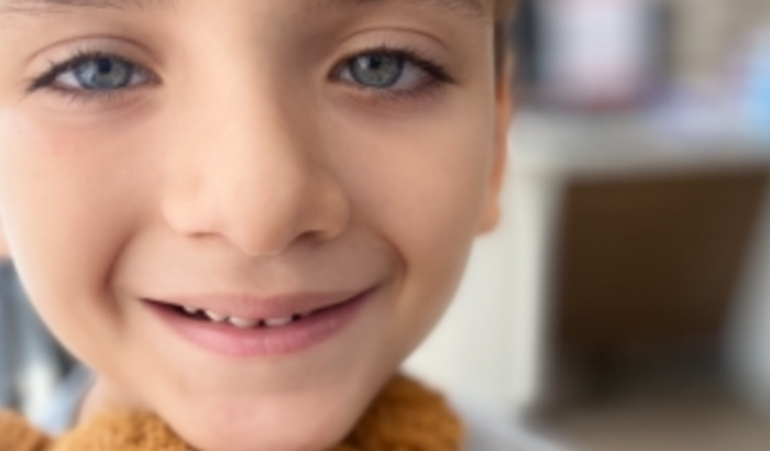 Tratamento Especializado Autismo para Davi