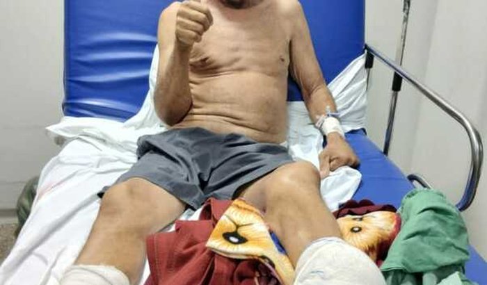 Ajuda com tratamento de diabete para evitar amputação da perna