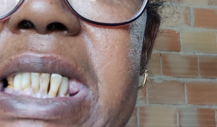 Tratamento dentário urgente 