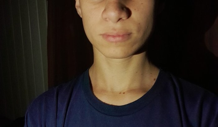 Me ajudem a enxergar. Implante de anel de ferrara (ceratocone).