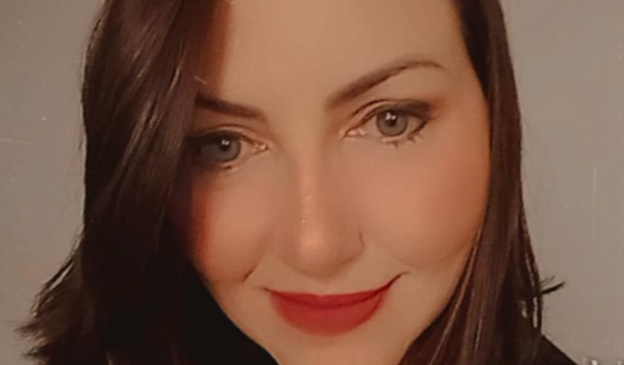 RECONSTRUÇÃO SEIO ANINHA