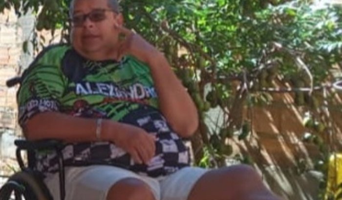 Ajuda para compra uma Prótese