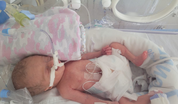 UTI NEONATAL PARA O HEITOR