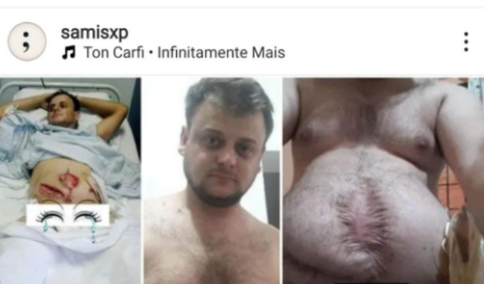 Ajuda financeira para nosso Amigo Sami Xavier