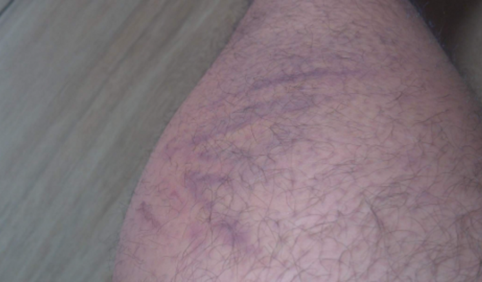 Ajuda para minha cirurgia 