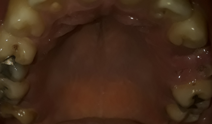 Devolvendo o sorriso