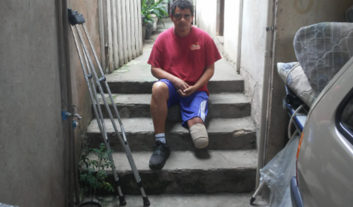 Prótese (Perna esquerda) 