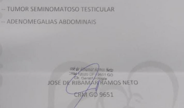 Tratamento de câncer do Jamerson (Tinda)