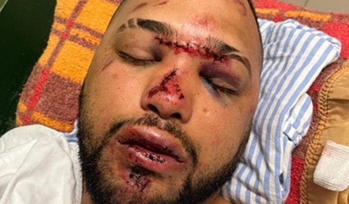 Ajuda ao Serginho - Acidente de Moto