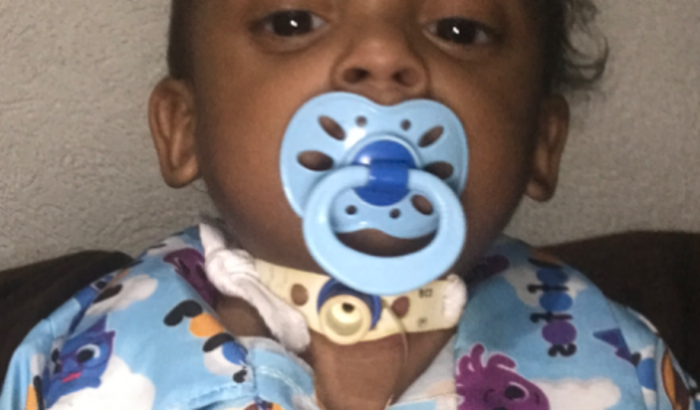 broncoscopia  para o Samuel